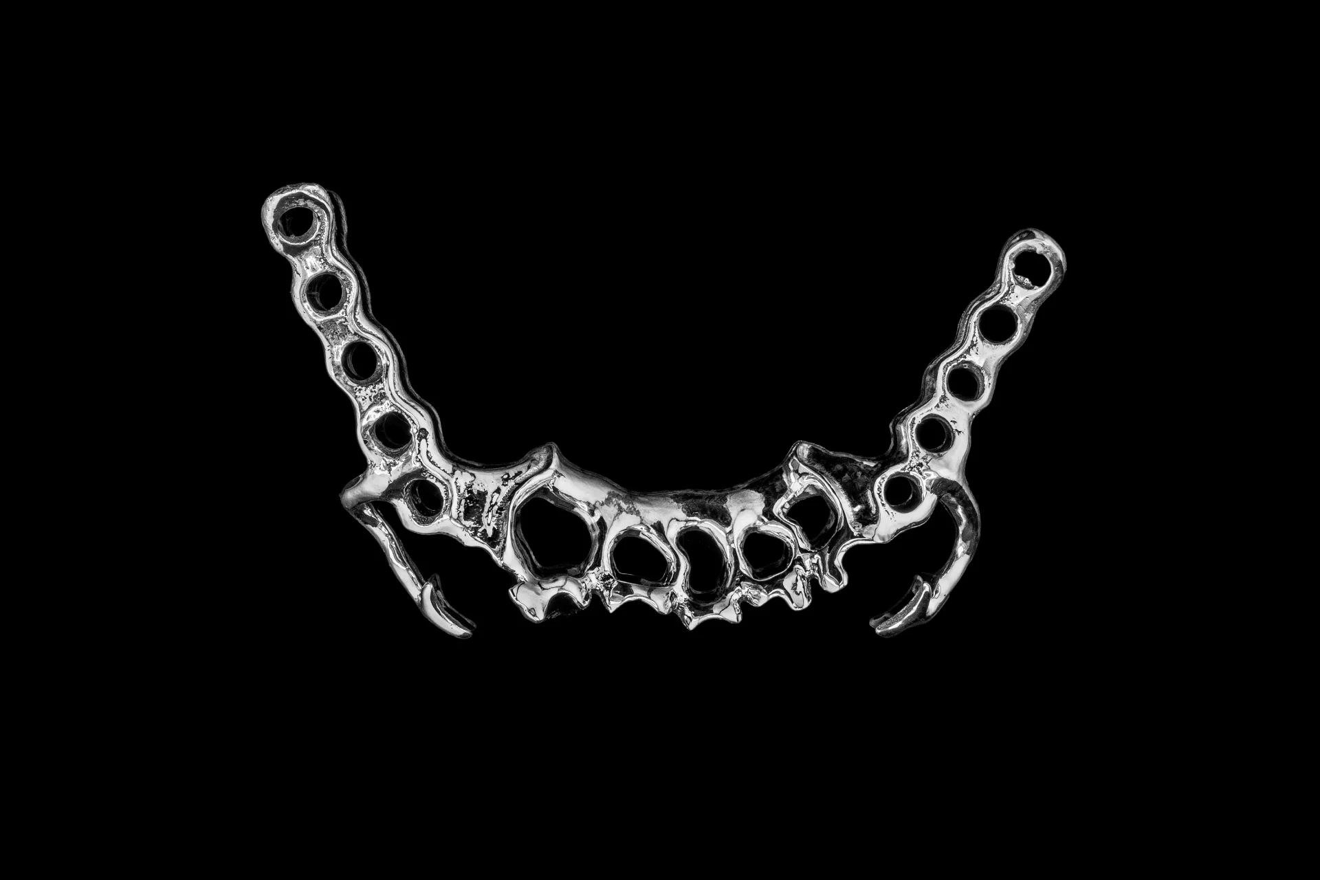 Slm dentures 9